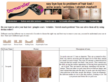 Tablet Screenshot of dermaroller-malaysia.com